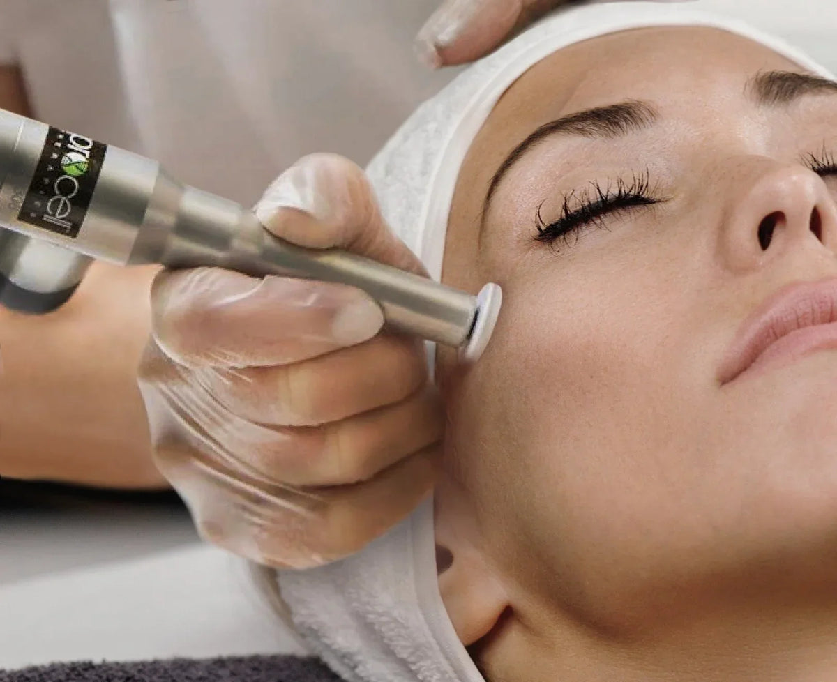 Procell Microchanneling Treatment