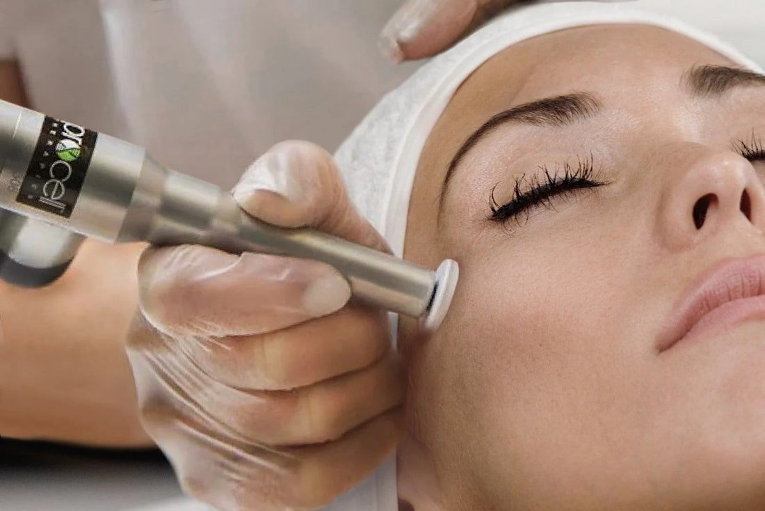 Person receiving a facial treatment ProCell MicroChanneling